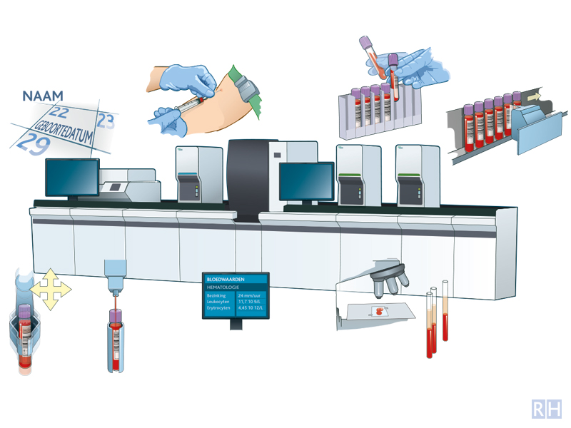 infographic bloedtransfusie machine